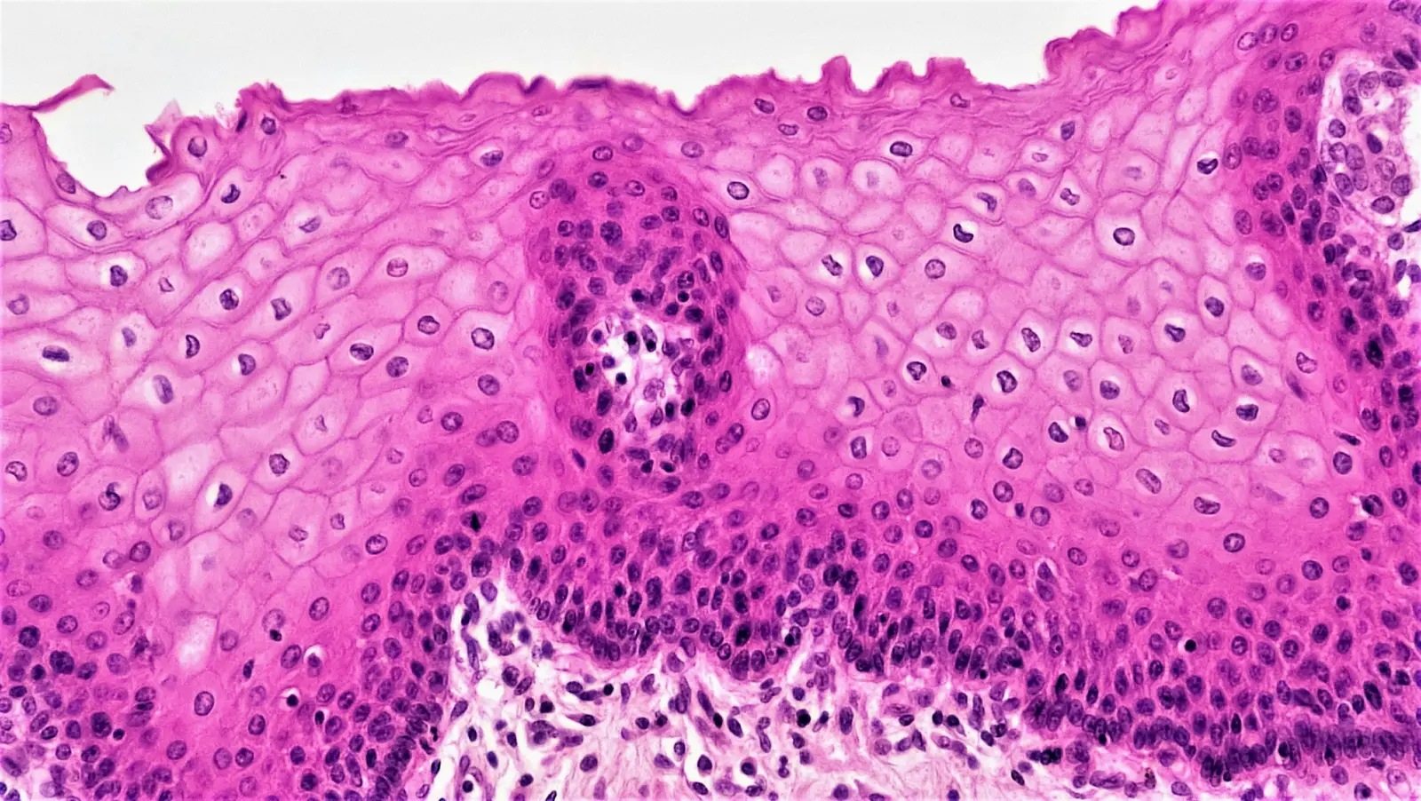 Micrografía histológica de tejido teñido para evaluación clínica